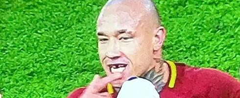 拼抢激烈，纳因戈兰在比赛中被撞掉了一颗牙